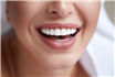 Implanturi dentare sau fațete dentare: Ce tip de lucrare alegem pentru un zâmbet perfect?